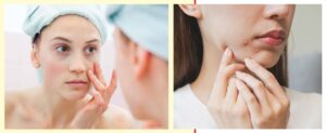 Make sure the pimple is actually ready to pop When it comes to caring for our skin, popping pimples is a huge no-no. Although we are told we are not supposed to do it, we all pop our zits from time to time. There is something so satisfying, addictive even, about getting the gunk out of our faces. If you just can’t stop popping your own zits, these are some things dermatologists want you to keep in mind. Pop the right pimple First of all, the pimple you are trying to pop has to be ready. In essence, you are looking for a pimple with a white tip, known as a pustule, or more commonly, a whitehead. If the pimple you are trying to pop is a deeper nodule (the firm, painful red kind), you should avoid it altogether. The inflammation and debris and pus can spill underneath the skin when popped wrongly; that’s what leads to further inflammation, infection and even scarring. Cleanliness is key Next, you need to make sure the area and your hands are cleaned thoroughly. According to the expert, if a pimple has a clear ‘whitehead’, then you can wash your hands and wash the area with soap and water and apply gentle pressure from both sides. Use the right tools It is advised that the right tools should be used if pimples must be popped. Know when to stop Another thing to keep in mind, however badly you want to push and press at your zits, is to be gentle. When you actually pop your pimples, you want to just gently compress the area. You don’t want to squeeze too aggressively. Preventive measures According to Lamb, Isaac and the Palmisanos, the best and safest thing to do is to see a professional. You can also try topical treatments to help dry out your pimples, which may help mitigate the desire to pop them. These treatments should be used in small amounts, once or twice a day.