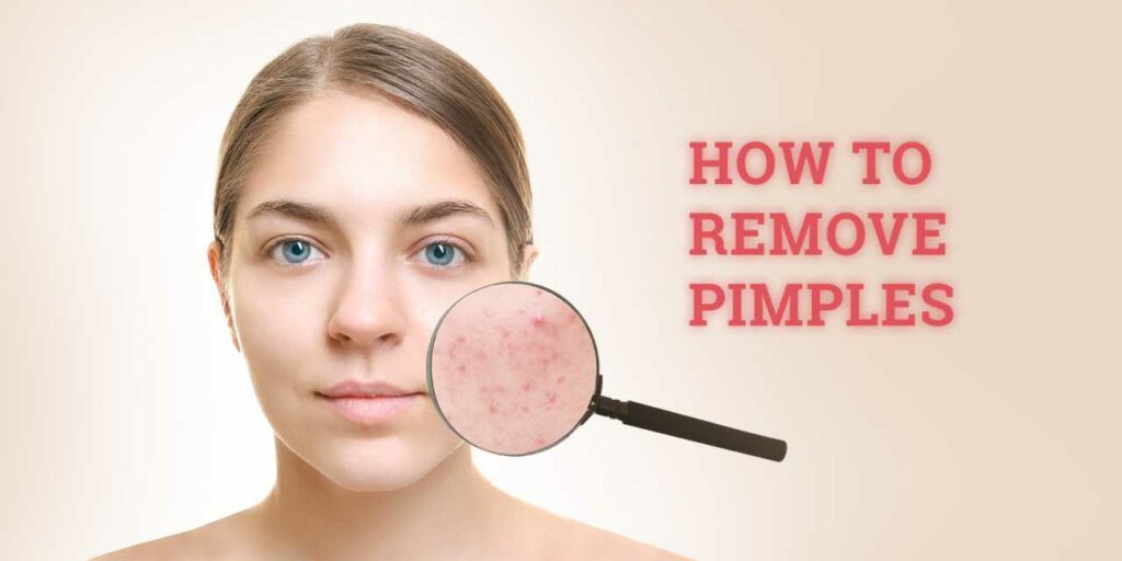 Simple ways to avoid acne